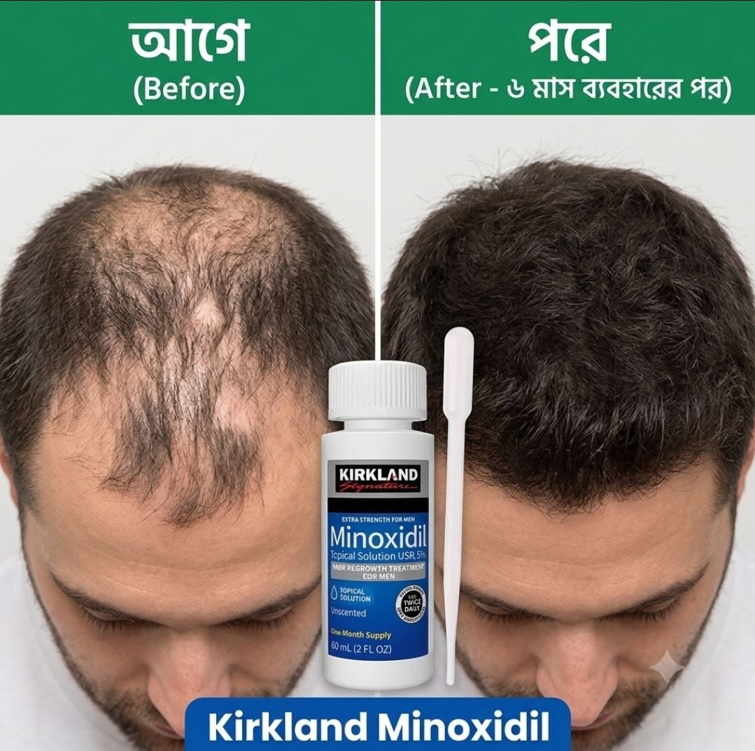 Kirkland 5% "Minoxidil+DRS" Derma Roller Combo