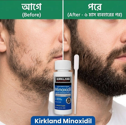 Kirkland 5% "Minoxidil+DRS" Derma Roller Combo